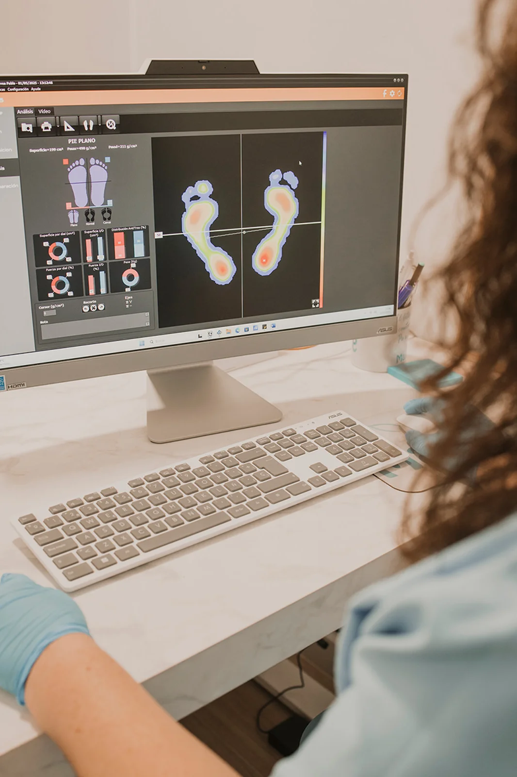 Análisis biomecánico(Estudio de la pisada) (1) 1